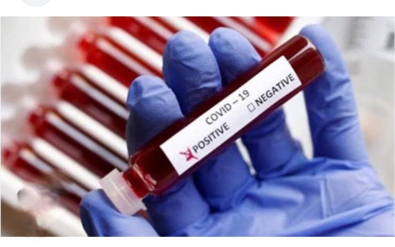 कोरोना काल के दौरान फर्जी कोविड -19 रिपोर्ट देने वाली