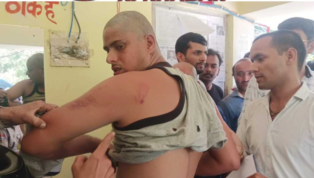 नैनीताल : फिर लगा वर्दी पर मारपीट का आरोप !