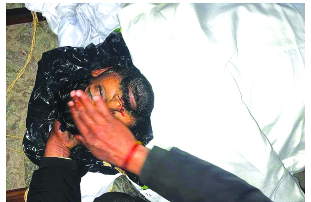 जनपद हरिद्वार : चाइनीज़ मांझे ने ली फिर एक जान