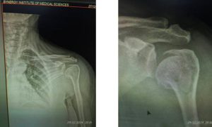 बड़ी खबर सिनर्जी अस्पताल पर लग रहे आरोप है निराधार