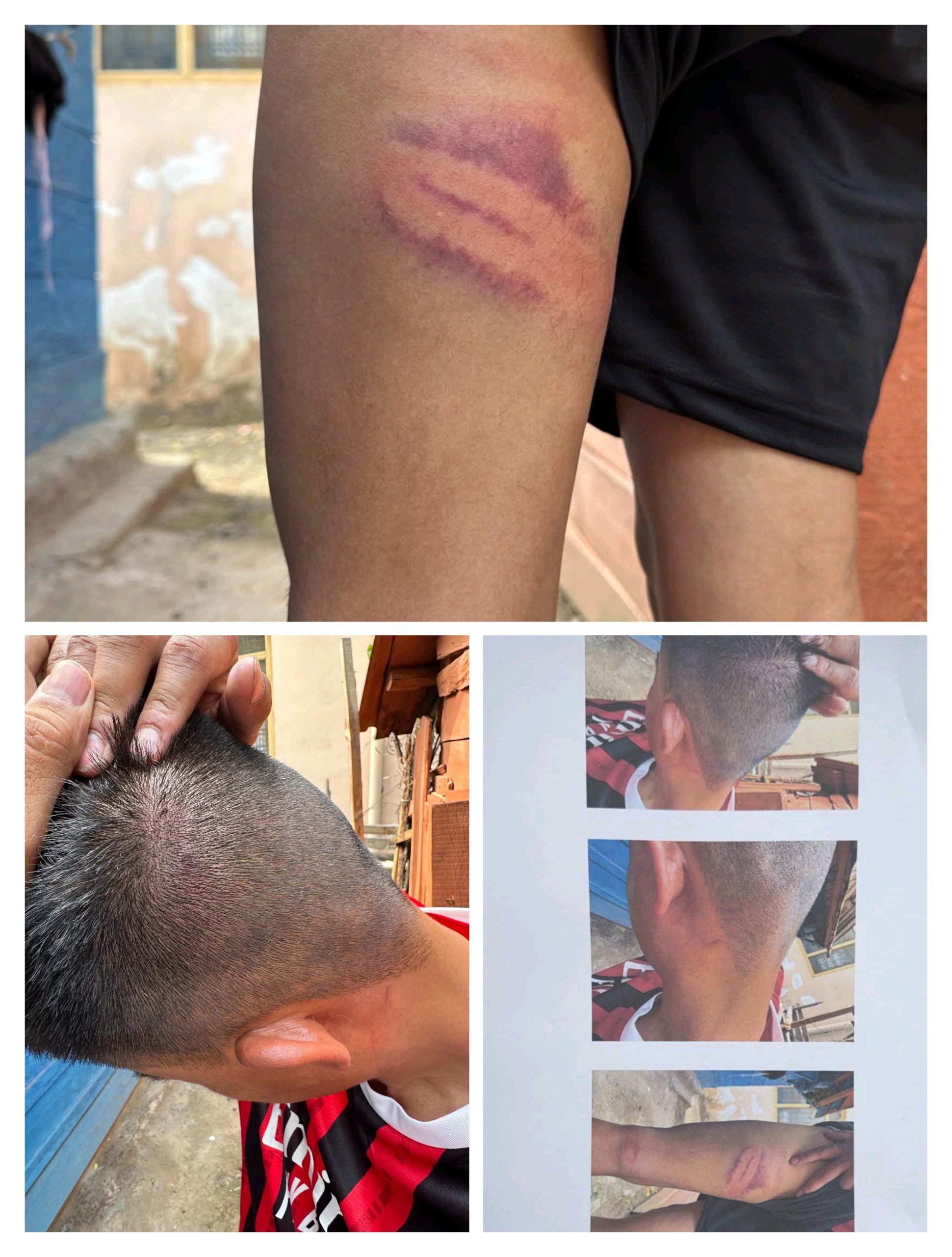 त्यूनी (चकराता) पुलिस पर लगे फौजी से मारपीट के गम्भीर