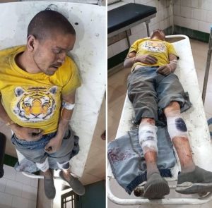 नैनीताल : सोशलमीडिया पर तहलका मचाने वाला बिरजू मयाल गिरफ्तार