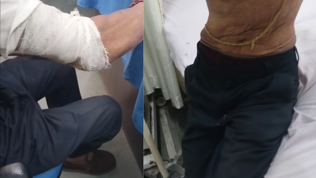 Rudraprayag: गुलदार ने शख्स पर किया हमला, श्रीनगर बेस अस्पताल भर्ती