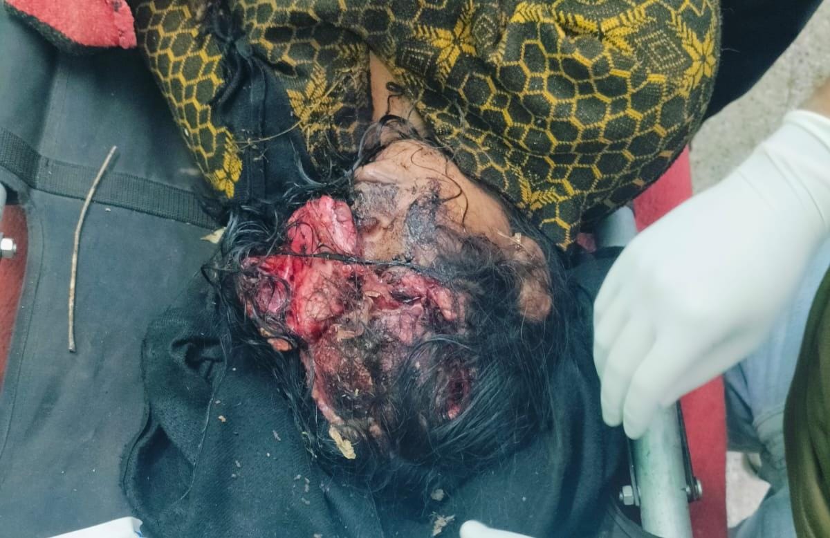 भालू के हमले में महिला गंभीर रूप से घायल,ग्रामीणों में