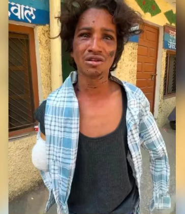 टिहरी में रिश्तों का खून ,सगे भाई पर किया हमला