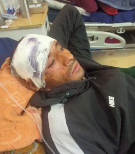 Shepherd airlifted to AIIMS Rishikesh after bear attack in Chamoli