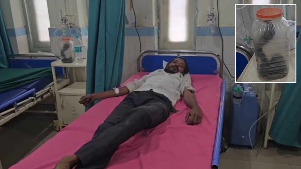पहले इसे संभाल लो… कोबरा के काटने के बाद युवक